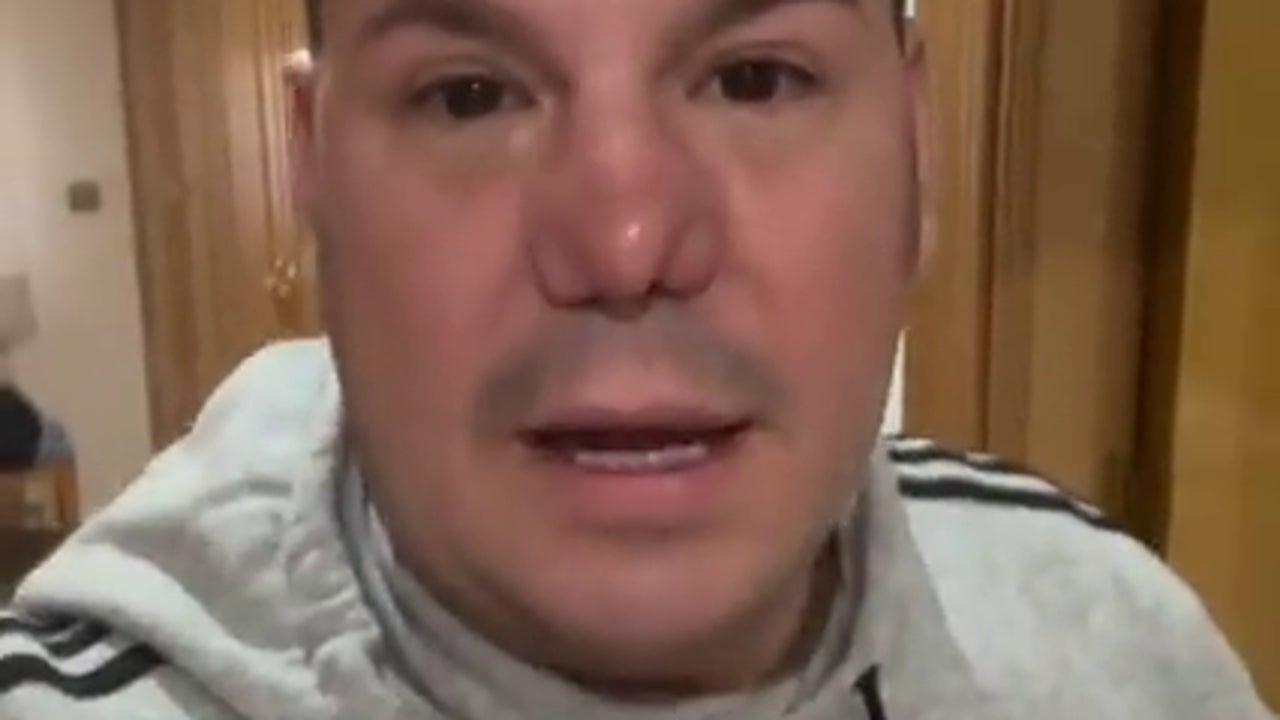la-drastica-decision-sobre-su-nariz-que-ha-tomado-lucas,-de-andy-y-lucas